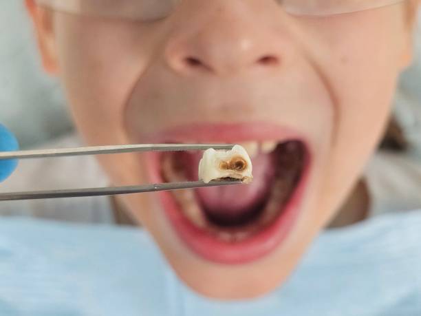 Best Broken or Chipped Tooth Repair in Newmanstown, PA